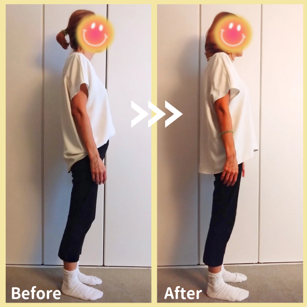 before&after
